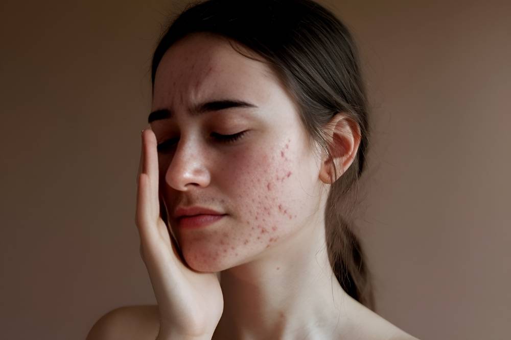 Binlerce Kadının Maruz Kaldığı Bir Linç Kültürü: Skin Shaming Nedir?